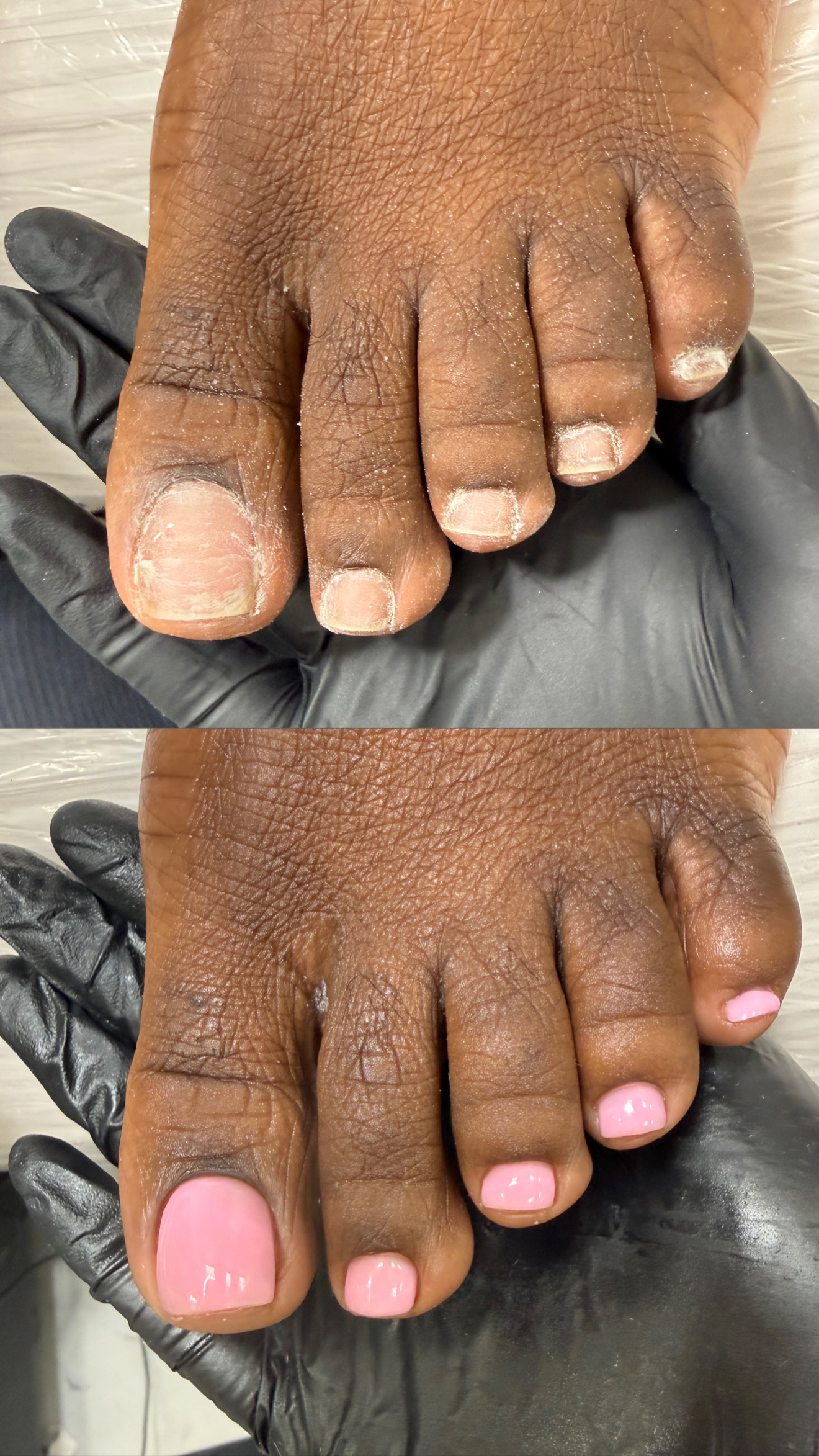 Before and after gel pedicure result in Manhattan
