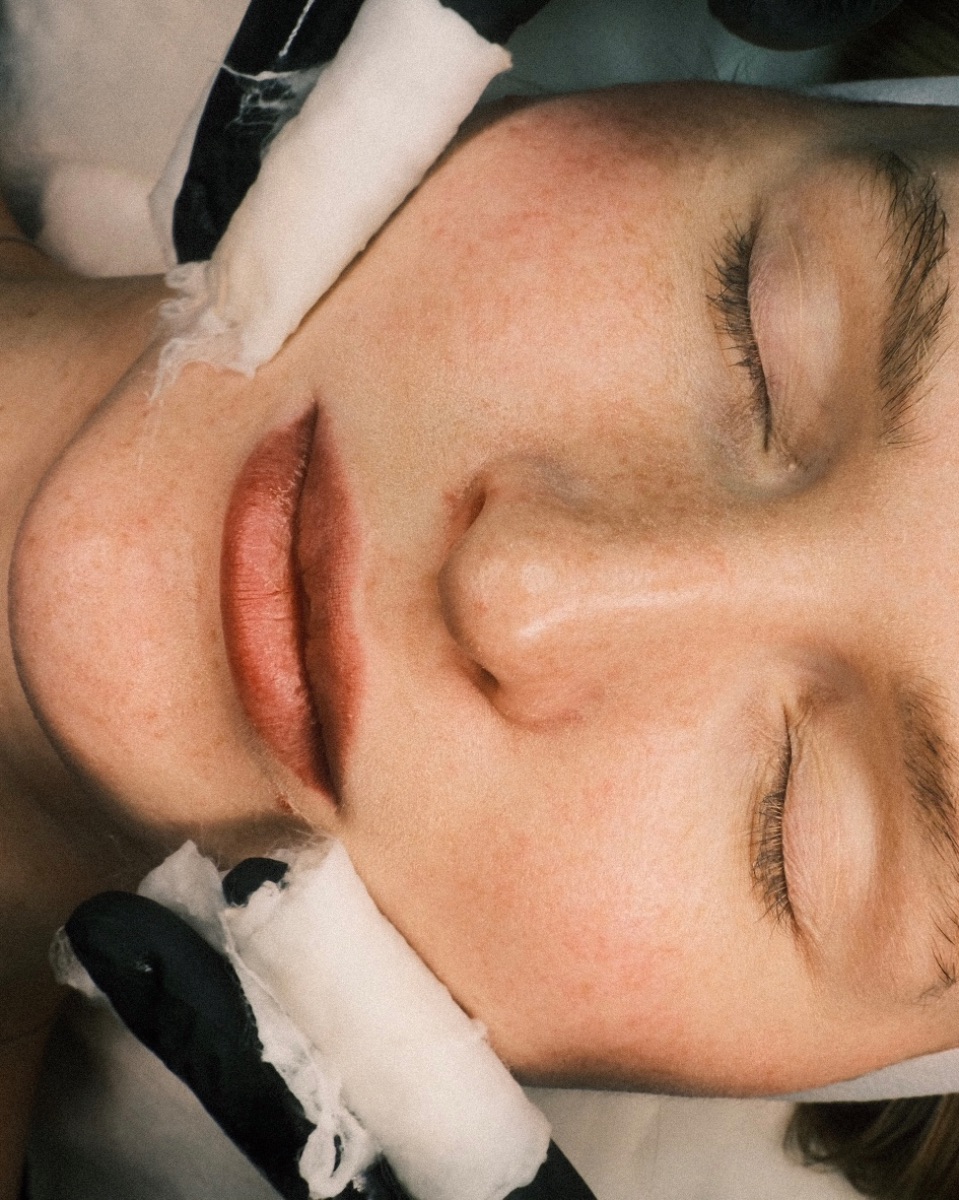 Professional facial treatment near NoMad, Manhattan