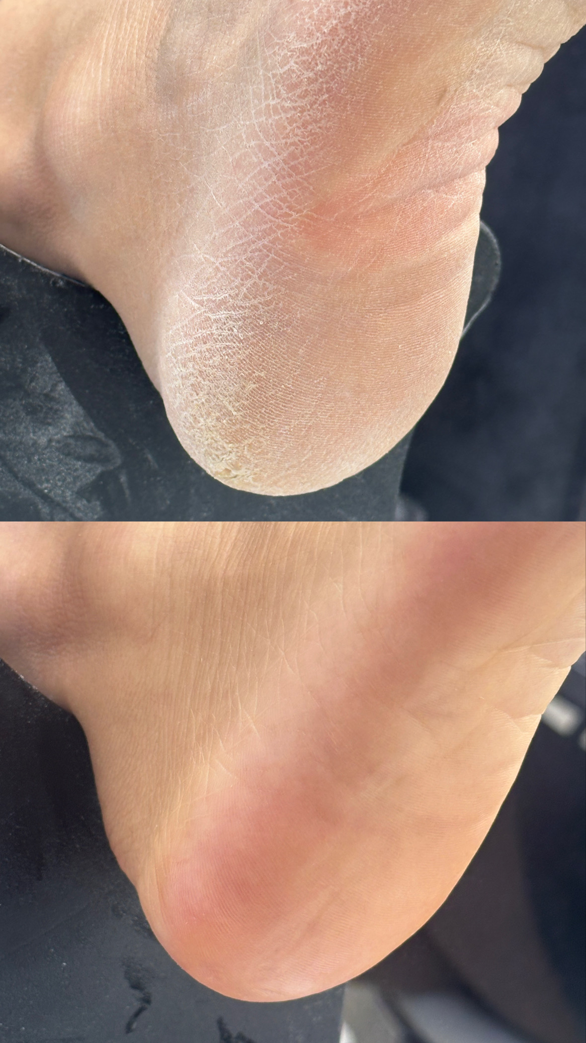 Heel Cleaning treatment at Darlings Beauty Lab beauty salon