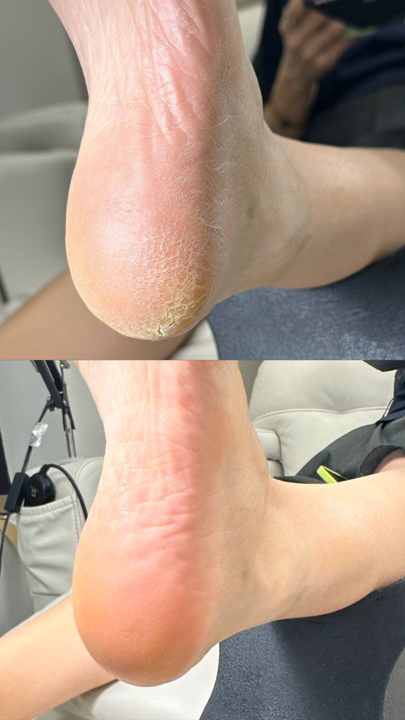 Heel Cleaning service result in Manhattan at Darlings Beauty Lab