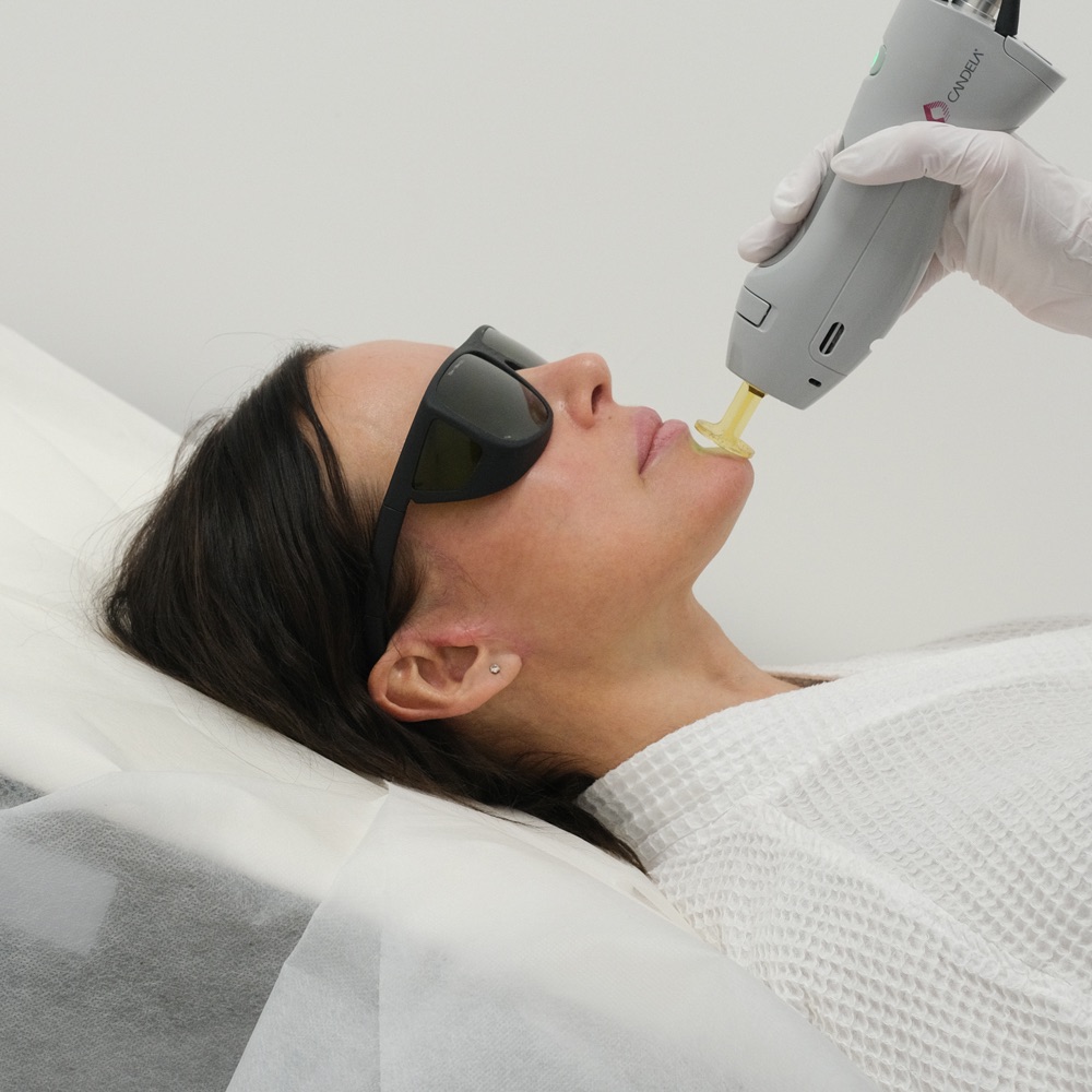 Laser skin rejuvenation treatment near NoMad, Manhattan
